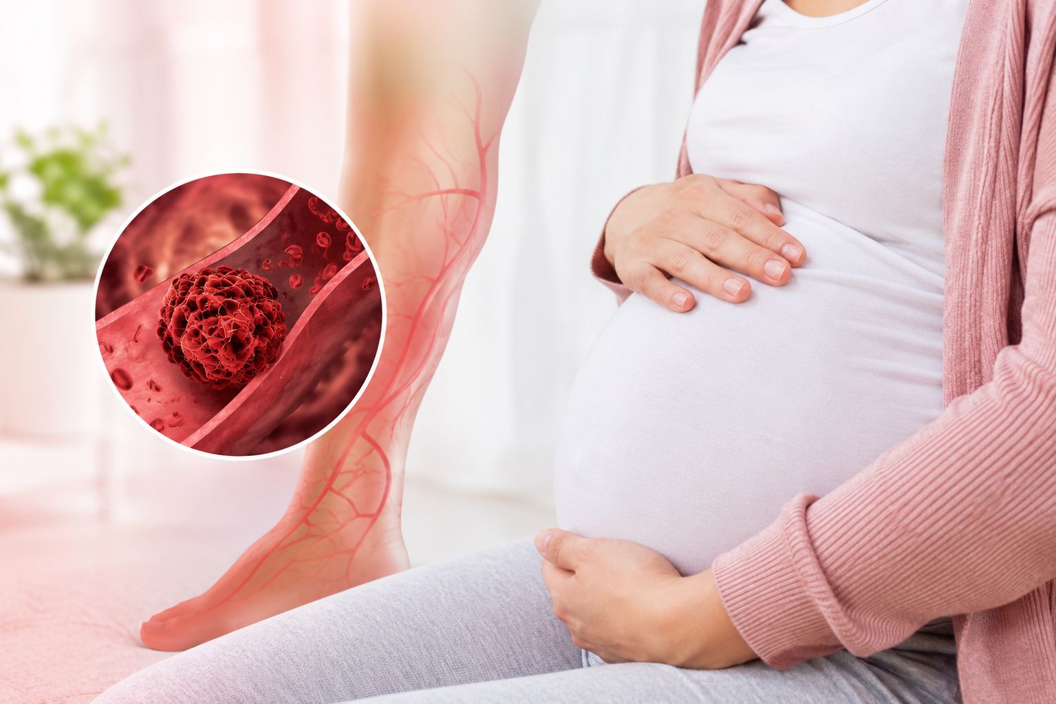 Blood Clotting Concerns in Pregnancy